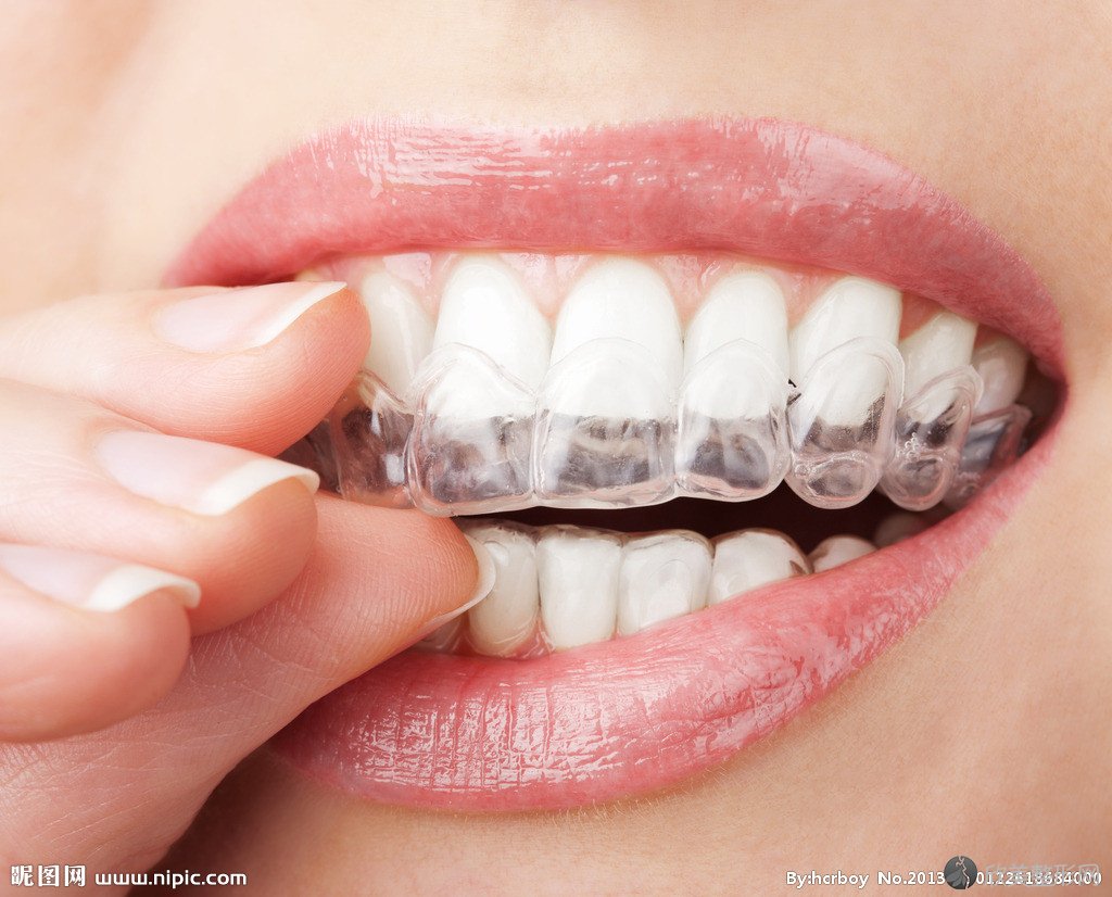 细数：牙齿做隐形矫正的步骤一般有哪些