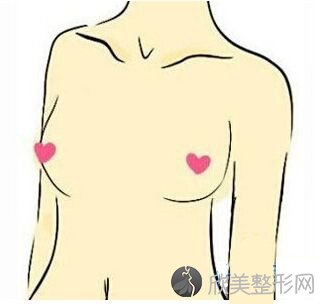上海做假体隆胸术后效果好不好