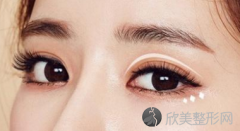 杭州做双眼皮手术大概需要多少钱