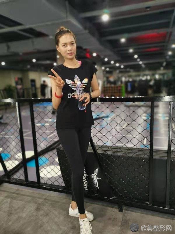 嘉兴市中医医院整形外科范建国做腰腹吸脂怎么样？附医生简介-腰腹吸脂案例