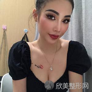 邯郸哪家医院做假体隆胸手术较好？盘点前三排行榜!邯郸市较好医院整形科、