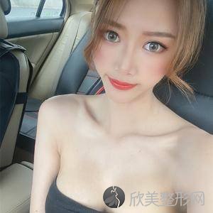 邯郸哪家医院做假体隆胸手术较好？盘点前三排行榜!邯郸市较好医院整形科、