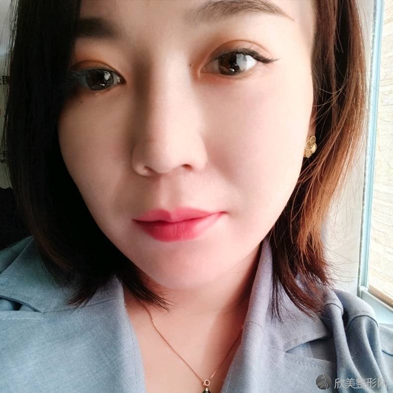 兰州市中医医院整形外科陈文莉做吸脂瘦脸怎么样？附医生简介-吸脂瘦脸案例