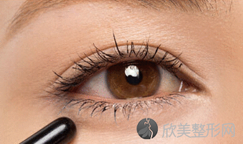 广州做眼睛双眼皮修复手术需要多少钱
