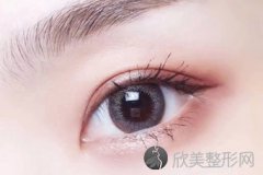 杭州医院做眼睛切开法双眼皮需要多少钱呢
