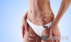 成都针灸减肥会有危害吗