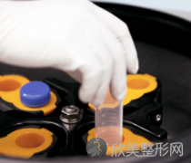曲靖做自体脂肪隆胸做几次效果好呢