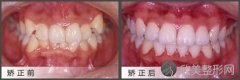 上海万众牙科做牙齿矫正好不好