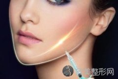 广州哪里打水光针比较便宜呢