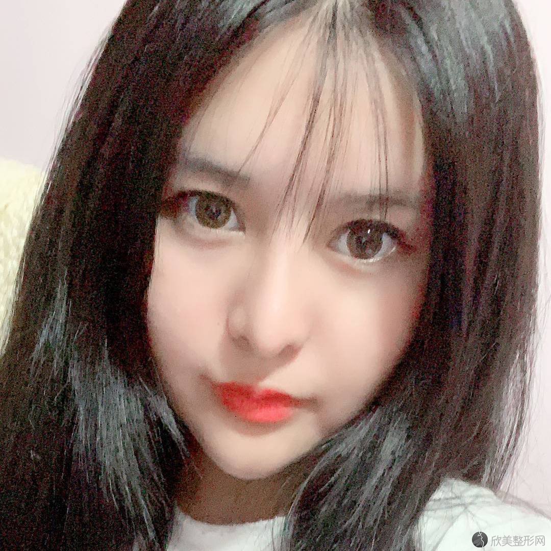 沈阳哪家医院做注射瘦脸效果比价好？排名前五口碑医院盘点-沈阳华美医院、