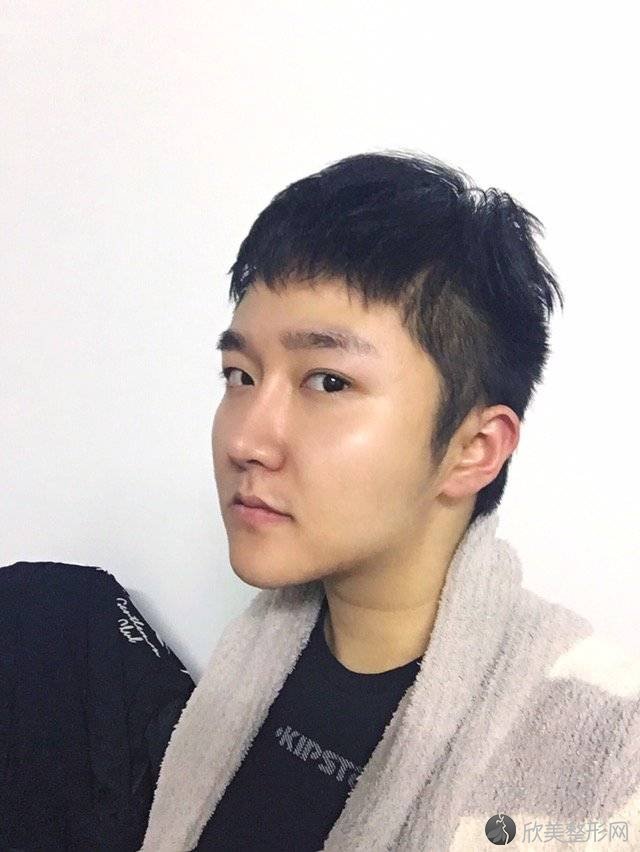 沈阳哪家医院做注射瘦脸效果比价好？排名前五口碑医院盘点-沈阳华美医院、