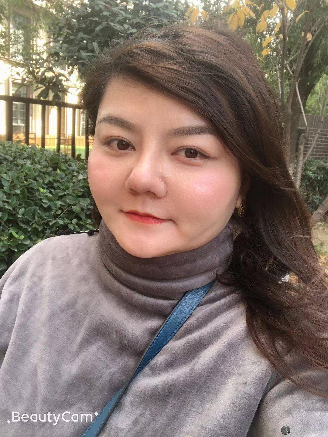北京杨仁宝医疗美容诊所杨仁宝做面部吸脂怎么样？附医生简介-面部吸脂案例