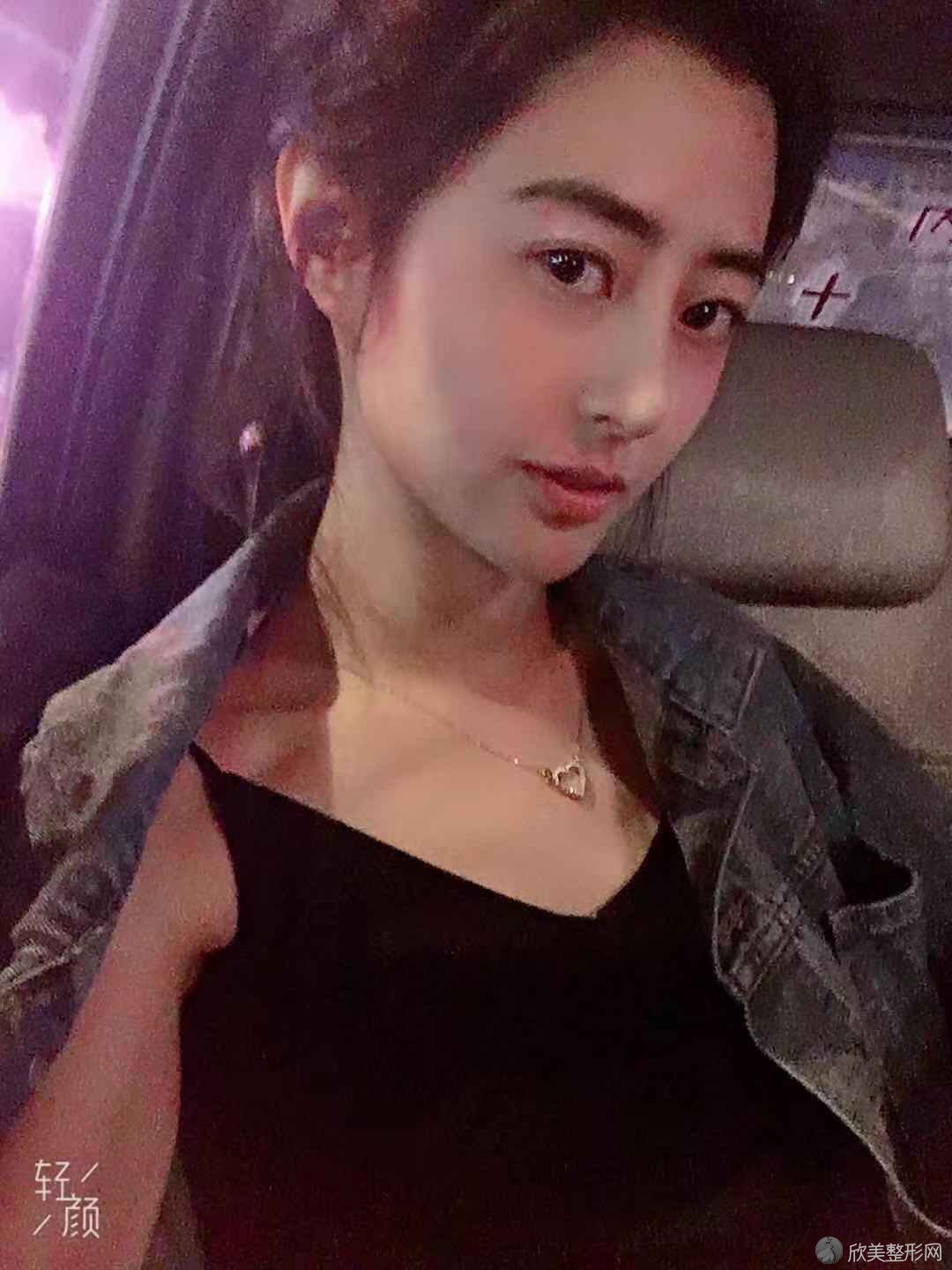 烟台华怡毛发移植中心徐茂武做自体脂肪填充面部怎么样？附医生简介-自体脂