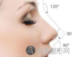 广州假体隆鼻能维持多长时间