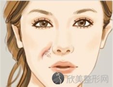 昆明美莱点阵激光大概多少钱