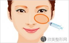 自体脂肪面部填充哪里较好呢