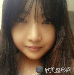 铁岭哪家医院做轮廓三件套较好？当属刘医生、姜红艳、美嘉丽这三家!价格(案