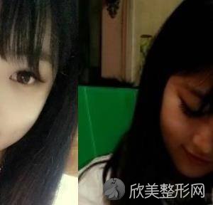 铁岭哪家医院做轮廓三件套较好？当属刘医生、姜红艳、美嘉丽这三家!价格(案