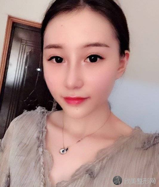 韩国丽儿整形高应烈做自体脂肪面部填充怎么样？附医生简介-自体脂肪面部填