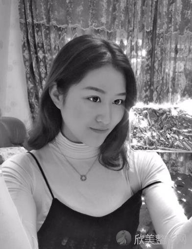 哈医大一院美容整形究竟怎么样？内附较新整形价格表及热玛吉案例分享