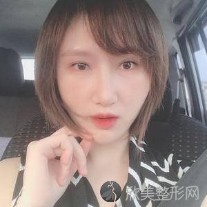 柳州哪家医院做轮廓三件套手术较好？排名前三奢颜、柳州第三人民医院、柳州