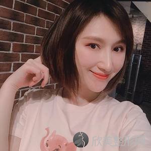 柳州哪家医院做轮廓三件套手术较好？排名前三奢颜、柳州第三人民医院、柳州