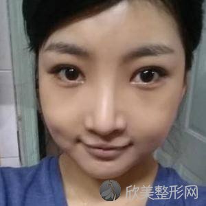 宿州哪家医院做轮廓三件套较专业？2021排行榜前五这几家都有资质-含砀山华美
