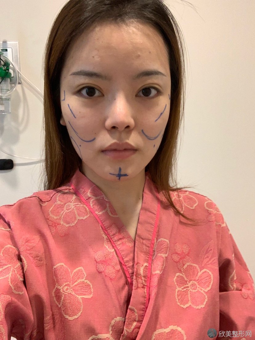 宿州哪家医院做轮廓三件套较专业？2021排行榜前五这几家都有资质-含砀山华美