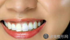 牙齿缝隙大可以矫正吗
