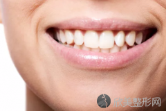 正畸咬合垫怎么吃饭