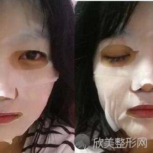 平顶山哪家医院做轮廓三件套好？2021排行榜前五这几家都有资质-含艺美、新华