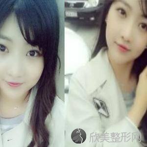 商丘哪家医院做轮廓三件套比较靠谱？排行榜医院齐聚-圣帝亚、永城市人民医