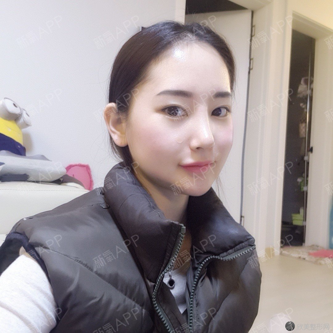 商丘哪家医院做轮廓三件套比较靠谱？排行榜医院齐聚-圣帝亚、永城市人民医