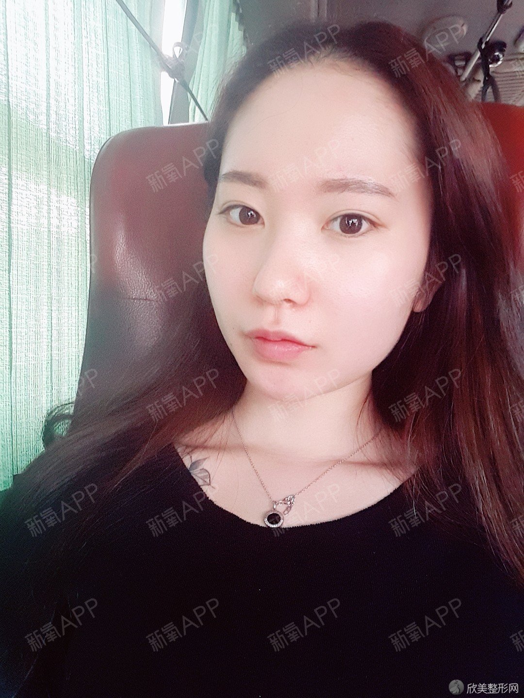 商丘哪家医院做轮廓三件套比较靠谱？排行榜医院齐聚-圣帝亚、永城市人民医