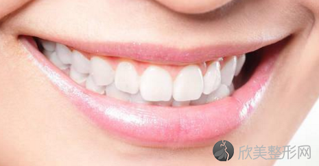 牙齿矫正的弊端是什么