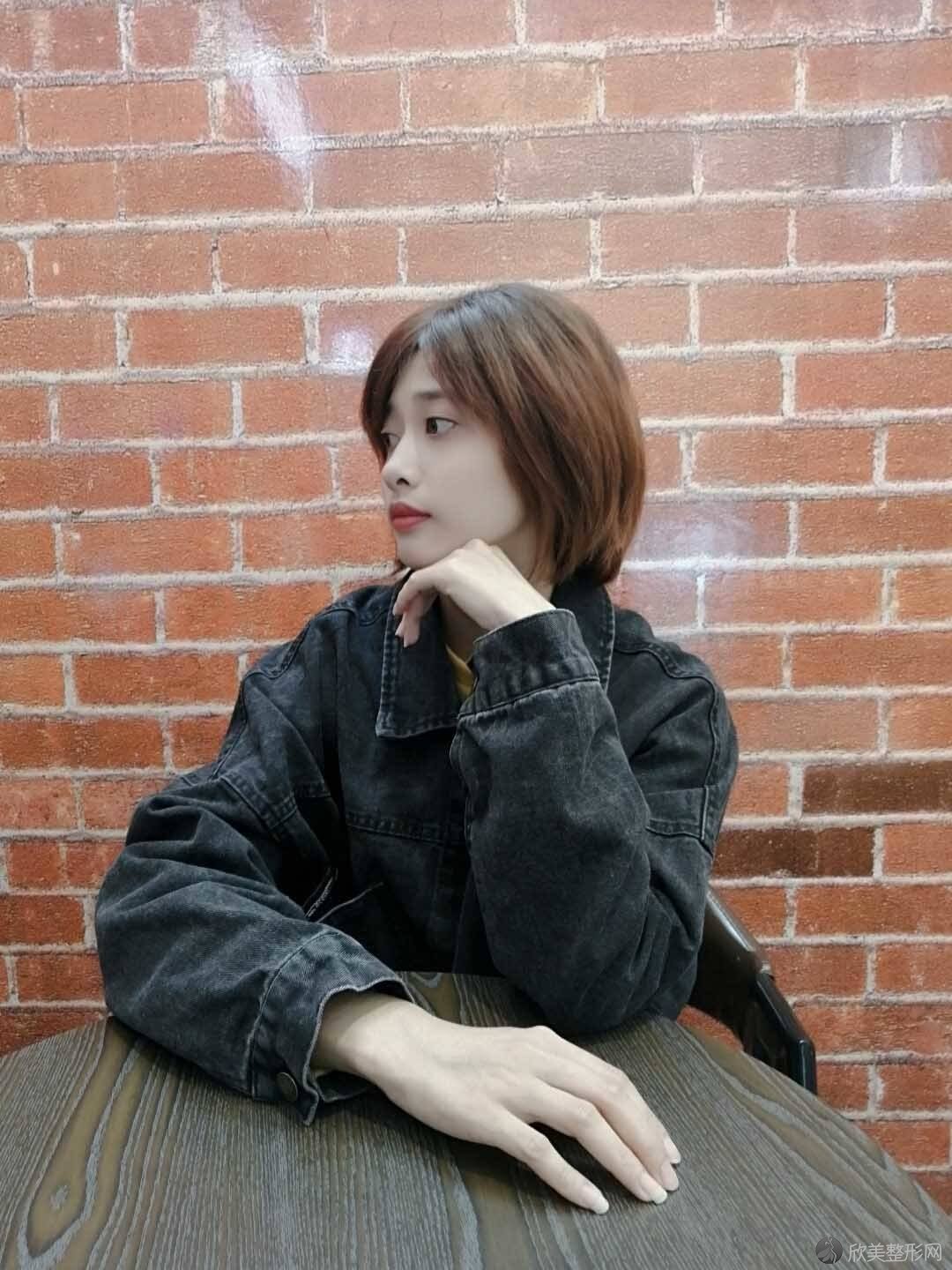 娄底爱思特医疗美容门诊部孙黎明做面部修复怎么样？附医生简介-面部修复案
