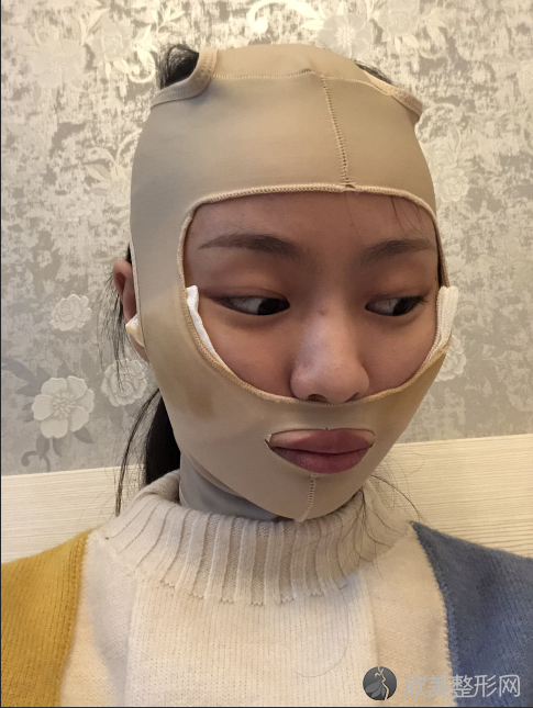 北京欧亚美医疗美容整形医院田雨做面部轮廓怎么样？附医生简介-面部轮廓案