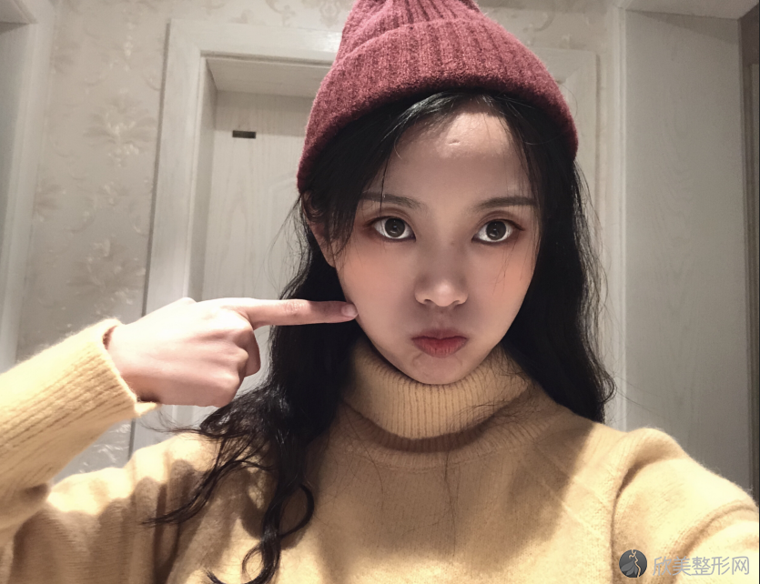 北京欧亚美医疗美容整形医院田雨做面部轮廓怎么样？附医生简介-面部轮廓案
