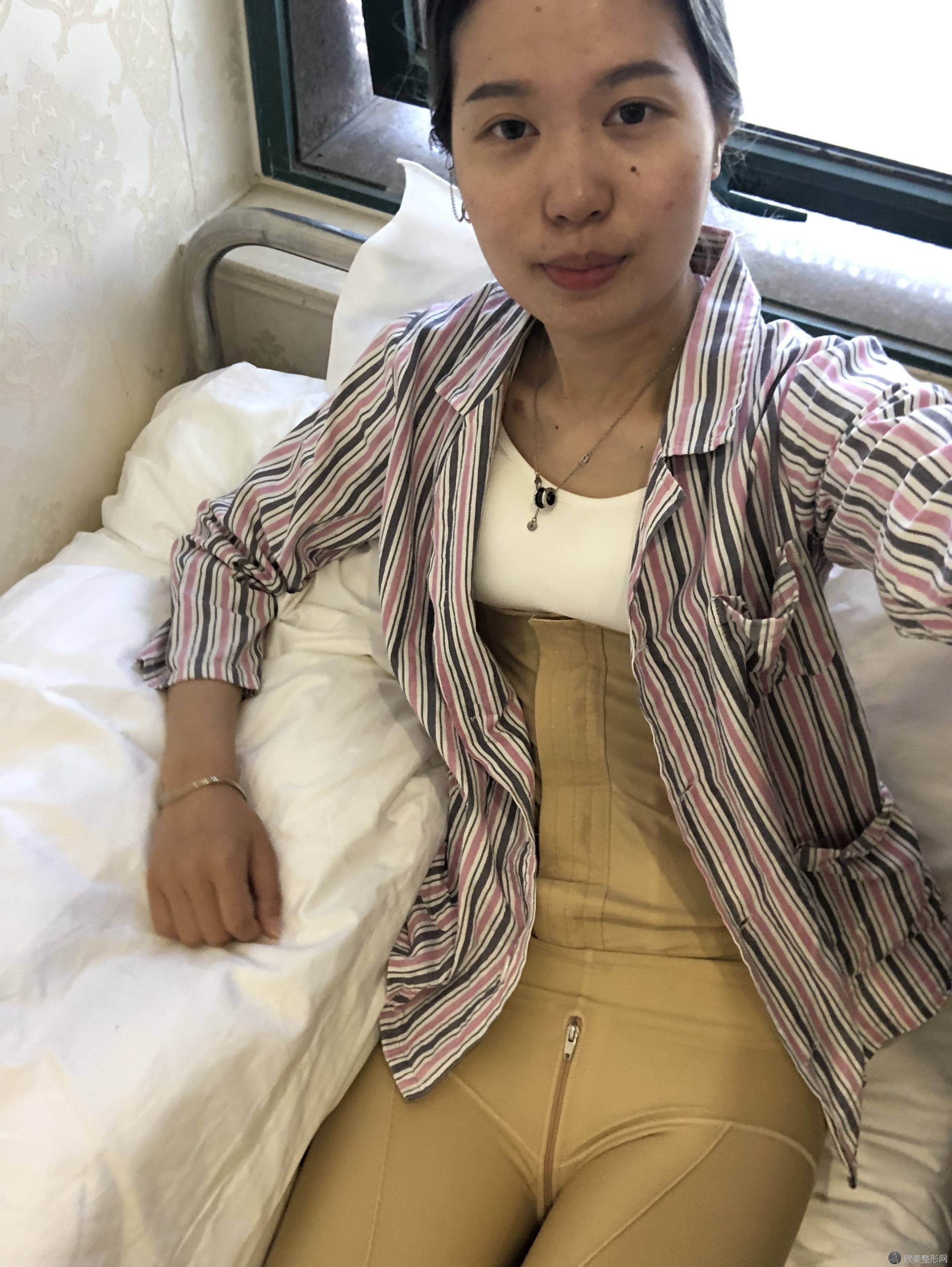 东湖区美皇医疗美容门诊部马万里做吸脂瘦腰腹怎么样？附医生简介-吸脂瘦腰