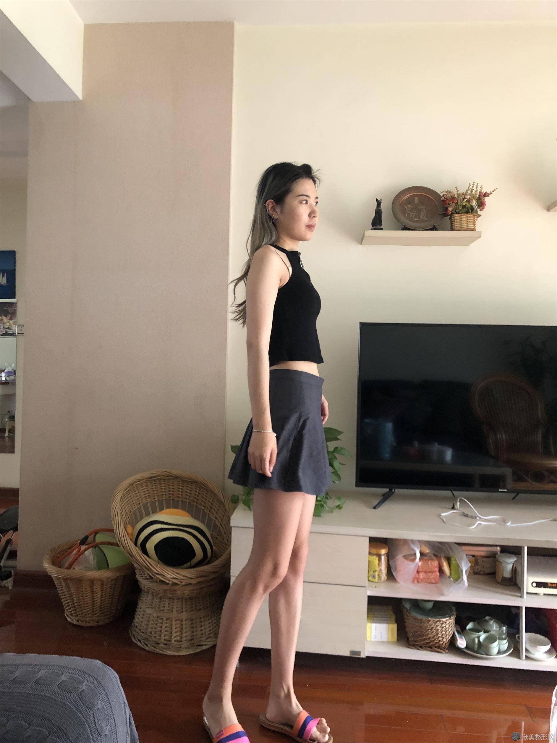 东湖区美皇医疗美容门诊部马万里做吸脂瘦腰腹怎么样？附医生简介-吸脂瘦腰