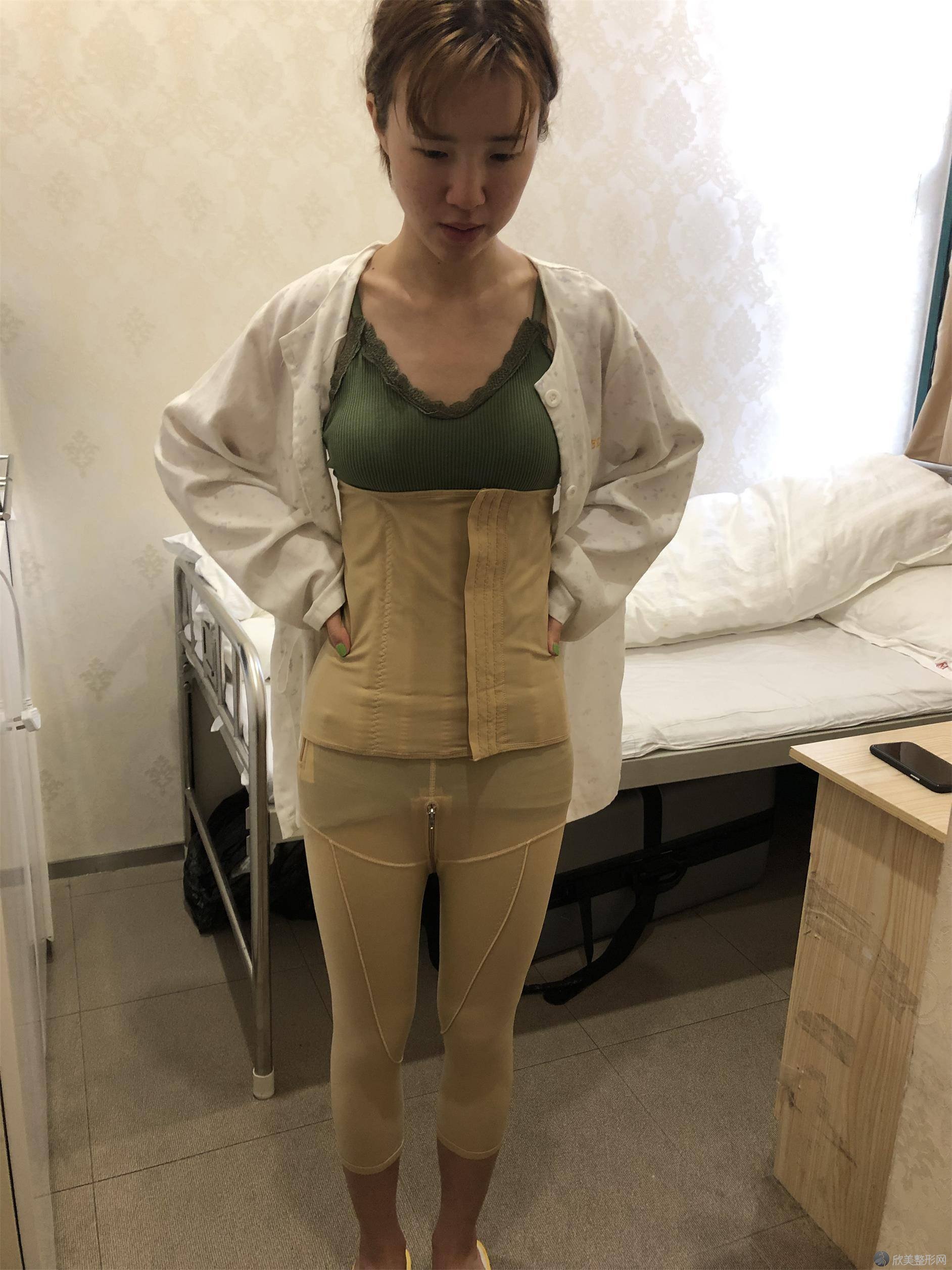 泰安女兵美容整形外科诊所黄建涛做吸脂瘦腰部怎么样？附医生简介-吸脂瘦腰