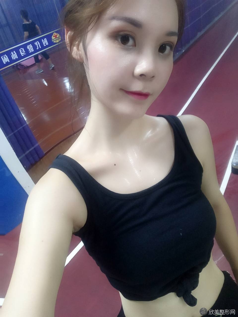 驻马店哪家医院做定点双眼皮好？排名列表公布!除美菲尔还有爱度、雅坤卫红