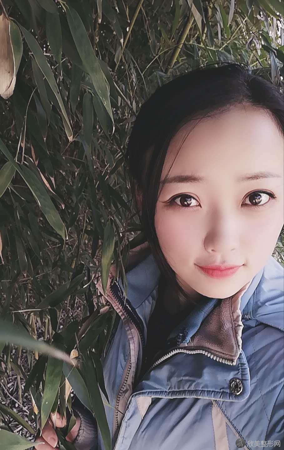 驻马店哪家医院做定点双眼皮好？排名列表公布!除美菲尔还有爱度、雅坤卫红