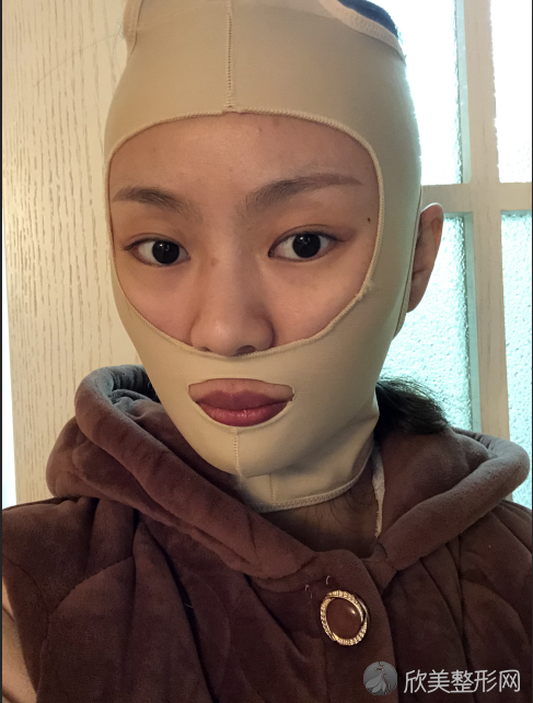 上饶江洲整形美容医院肖发才做自体脂肪填充面部怎么样？附医生简介-自体脂