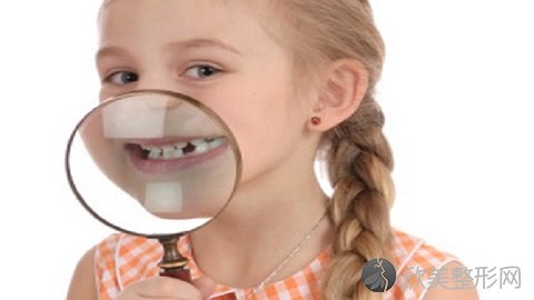 儿童换牙门牙不齐用不用矫正