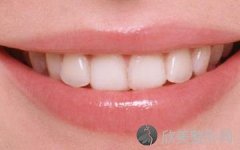 牙牙龈出血是什么原因