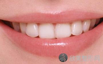 牙牙龈出血是什么原因