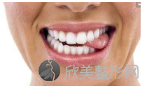 上海矫正牙齿的价格是多少