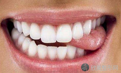 年轻人牙龈萎缩是什么原因