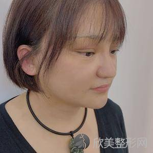 大庆哪家医院做假体隆鼻修复效果好？排名前四权威医美口碑盘点-含手术价格